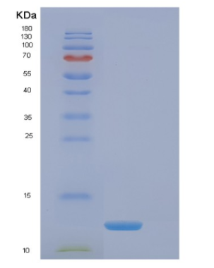 Recombinant Human EIF4EBP3 Protein