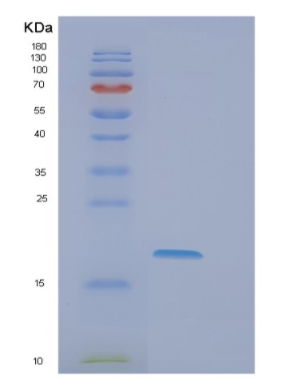 Recombinant Human EIF5A2 Protein