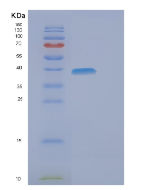 Recombinant Human ELAC1 Protein