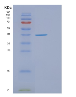 Recombinant Human ELAVL2 Protein