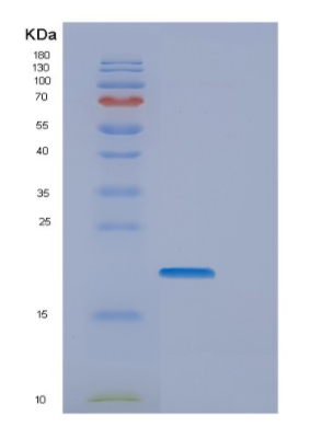 Recombinant Human EMCN Protein