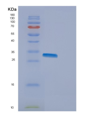 Recombinant Human EMG1 Protein