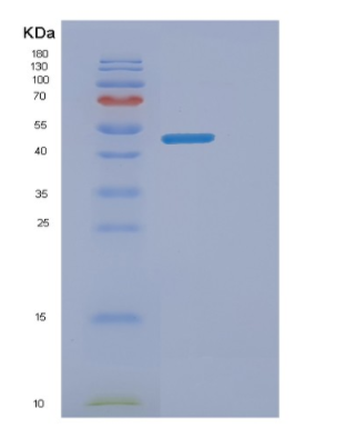 Recombinant Human ENTPD6 Protein