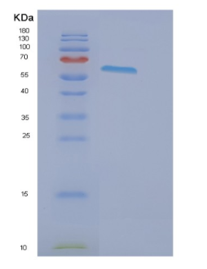 Recombinant Human EPHB2 Protein