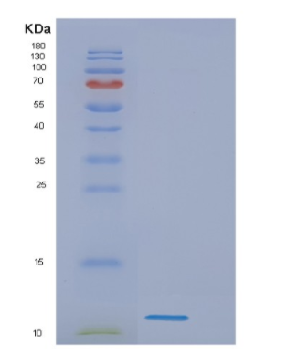 Recombinant Human Mycobacterium tuberculosis ESAT6 Protein