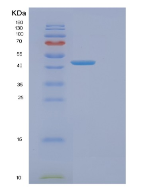 Recombinant Human ENO3 Protein