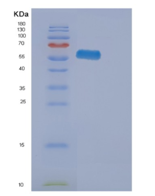 Recombinant Human EPHA2 Protein