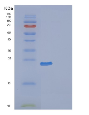 Recombinant Mouse Ephrin-B2 Protein