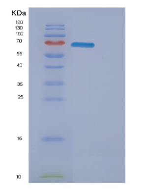 Recombinant Mouse ERBB3 Protein