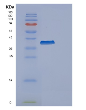 Recombinant Human ERLIN2 Protein
