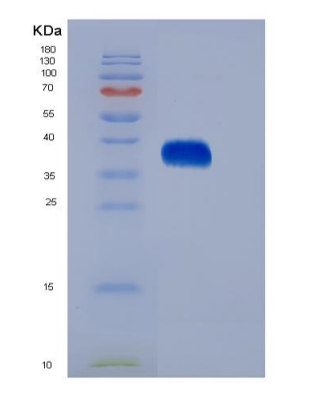 Eukaryotic Erythropoietin (EPO)