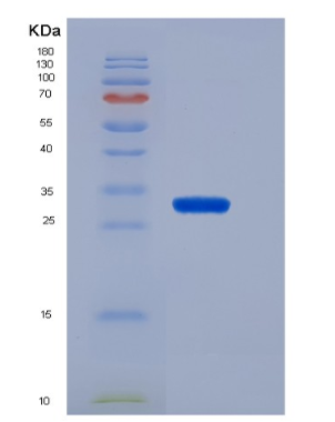 Recombinant Electron Transfer Flavoprotein Beta Polypeptide (ETFb)