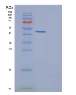 Recombinant Human ETS2 Protein