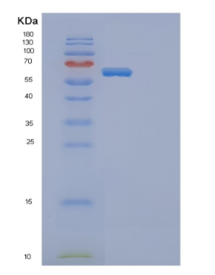 Recombinant Mouse Ephb4 Protein