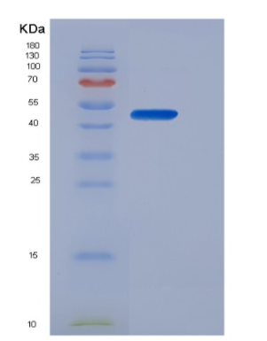 Recombinant Erythropoietin (EPO)