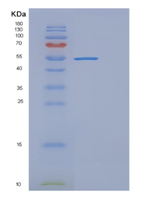 Recombinant Human EPO1L Protein