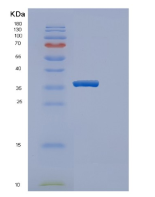 Recombinant Human ERGIC3 Protein