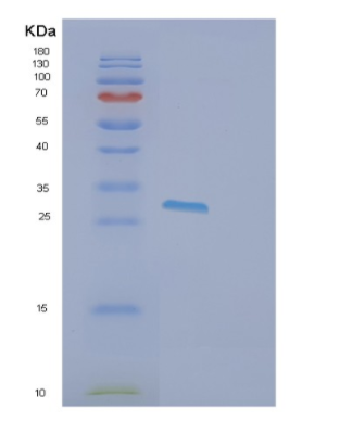 Recombinant Human ETHE1 Protein