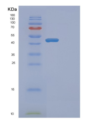 Recombinant Human ETNK2 Protein