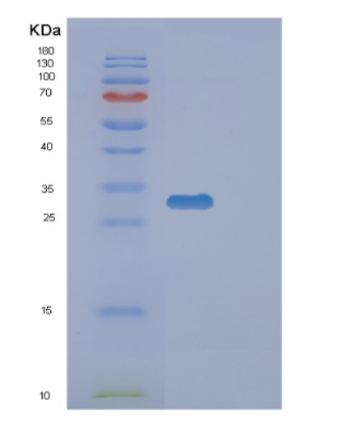 Recombinant Human EXOSC3 Protein