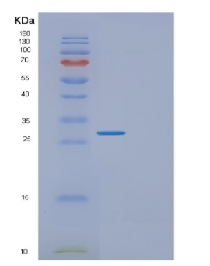 Recombinant Human EXOSC5 Protein