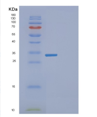 Recombinant Human EXOSC8 Protein