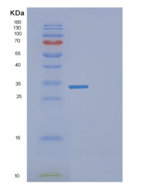 Recombinant Human EYA2 Protein