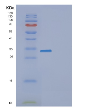 Recombinant Human F2 Protein