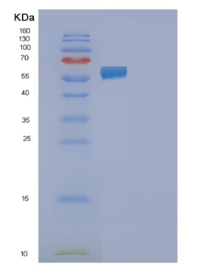 Recombinant Human FAAH2 Protein