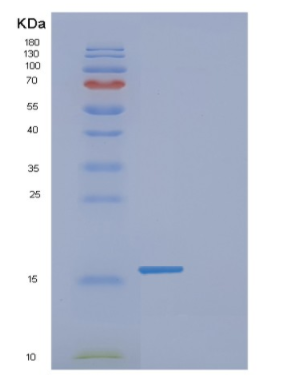 Recombinant Human FABP1 Protein