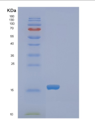 Recombinant Rat Fabp1 Protein