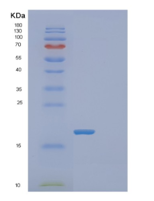 Recombinant Human FABP12 Protein