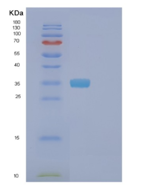 Recombinant Human FDFT1 Protein