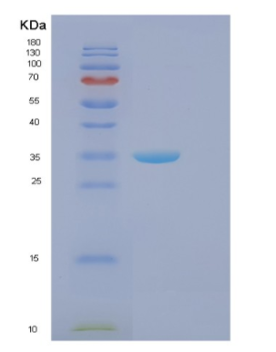 Recombinant Human FBXO2 Protein