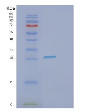 Recombinant Human FCGR3A Protein