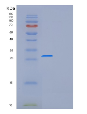 Recombinant Human FOLR1 Protein