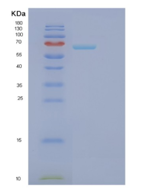 Recombinant Human FARSB Protein