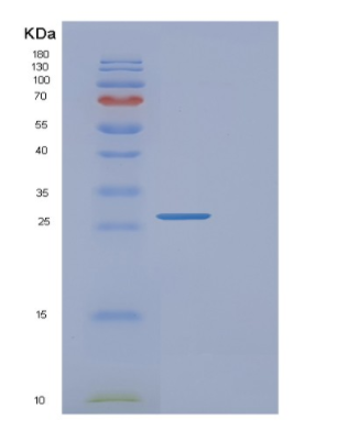 Recombinant Human FAIM Protein