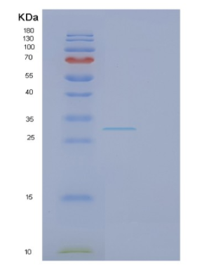 Recombinant Human FBL Protein
