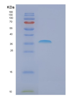 Recombinant Human FBXO6 Protein