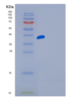 Recombinant Human FGFR4 Protein