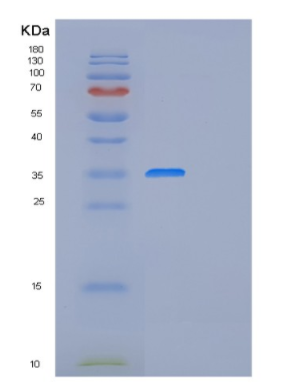 Recombinant Human FRZB Protein