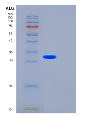 Recombinant Human FST Protein