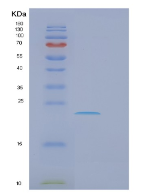Recombinant Human FCER1A Protein