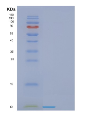 Recombinant Human FDCSP Protein