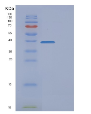 Recombinant Human FAM49B Protein