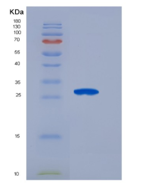 Recombinant Fibroblast Growth Factor 21 (FGF21)