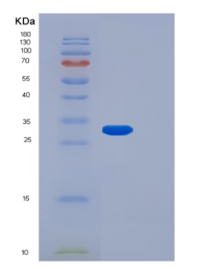 Recombinant Human FGF14 Protein