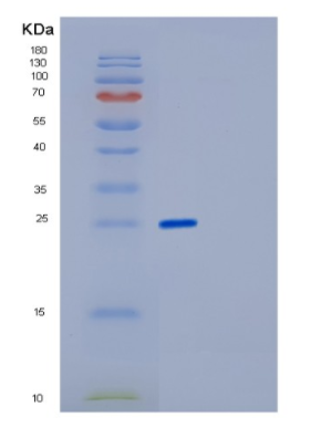 Recombinant Human FKBP3 Protein