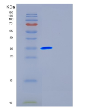 Recombinant Human FSTL1 Protein